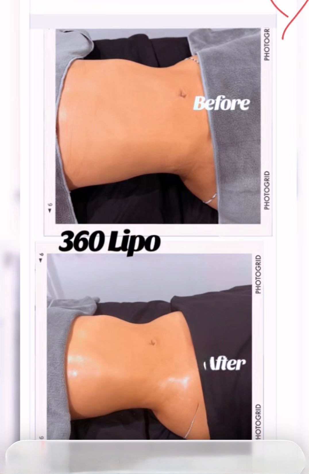 Before and after treatment results