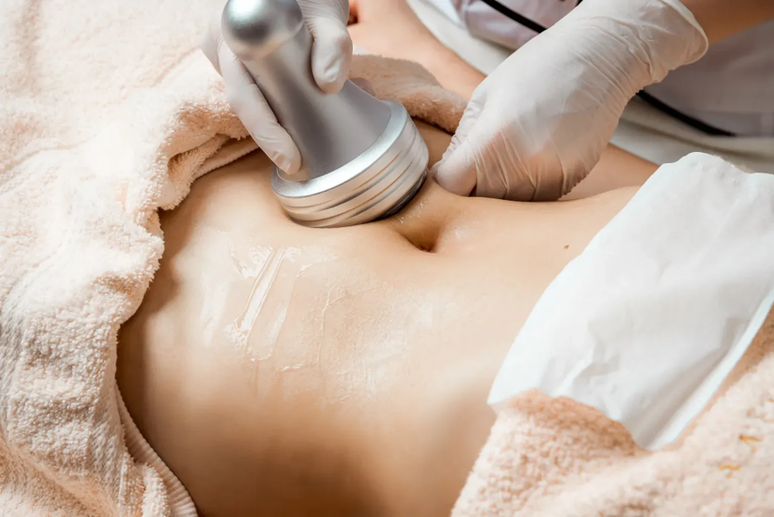 Radio frequency and ultrasonic cavitation treatment